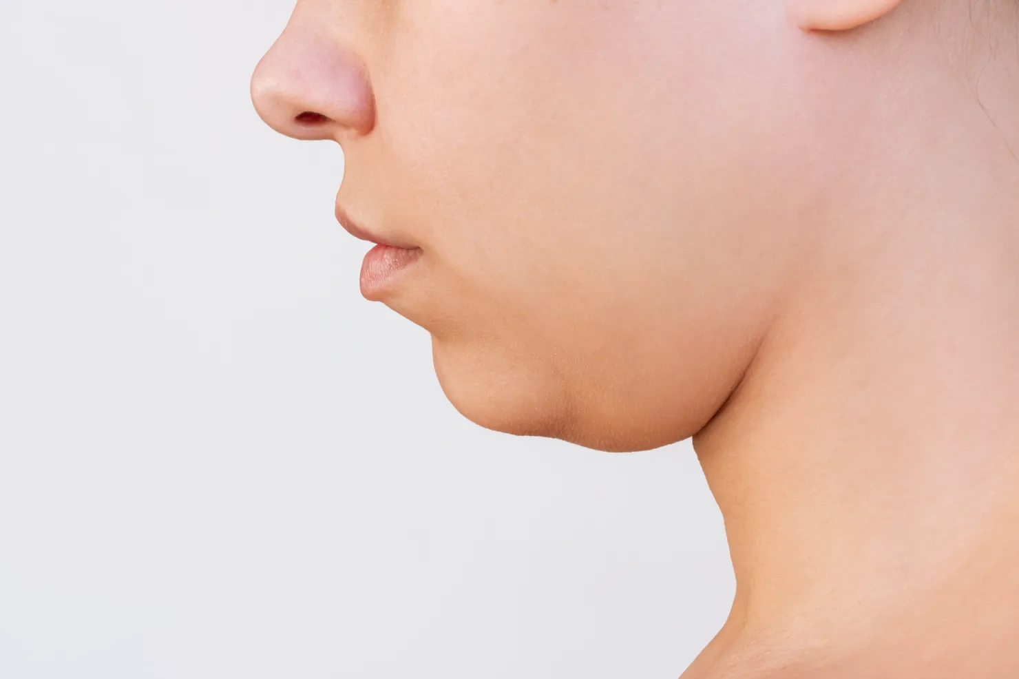 mengenal apa itu double chin treatment