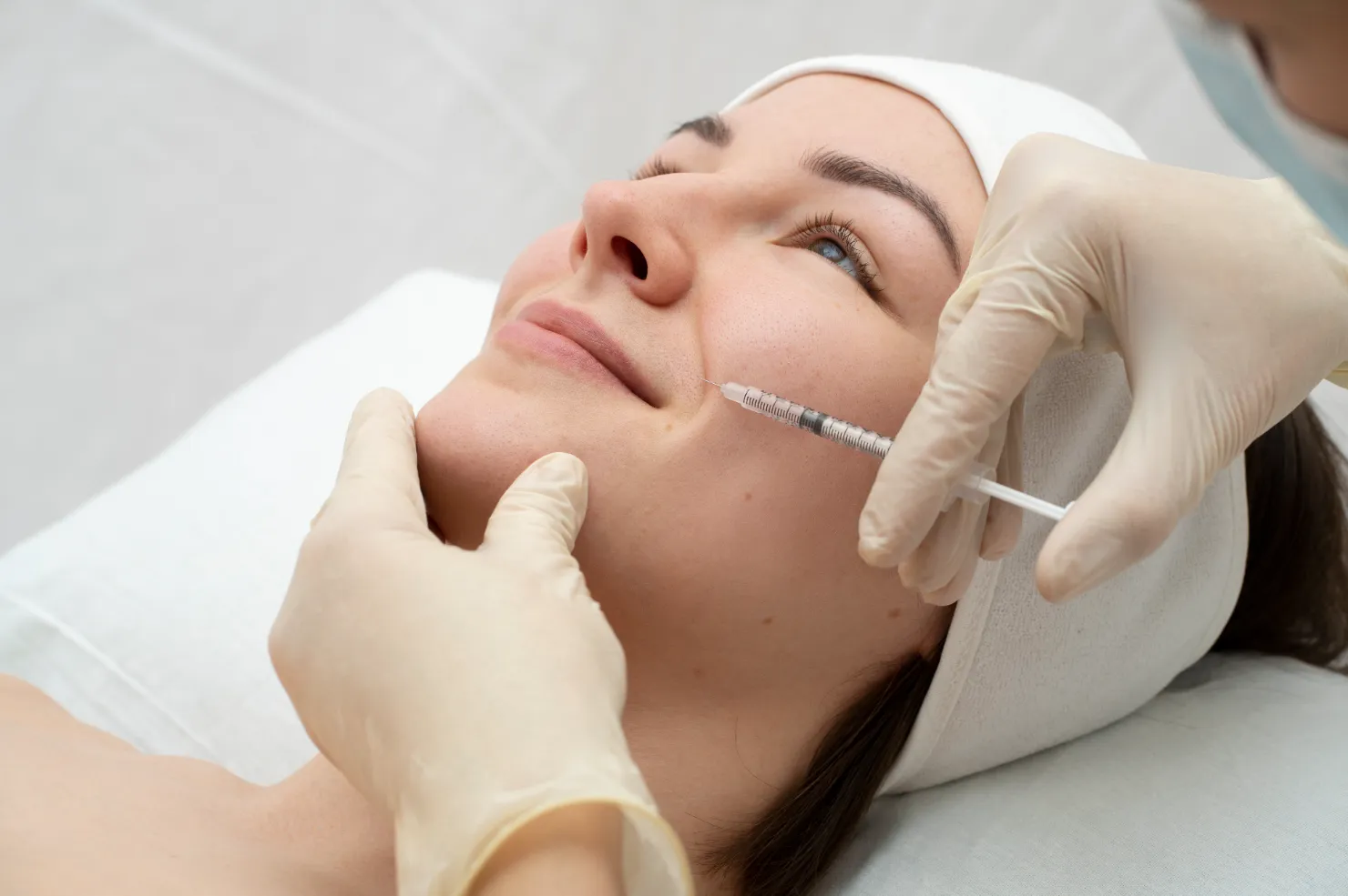 apakah filler bisa menghilangkan smile line