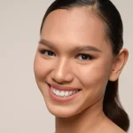 Filler Smile Line untuk Senyum yang Tetap Natural, Tanpa Garis Terlalu Dalam filler smile line