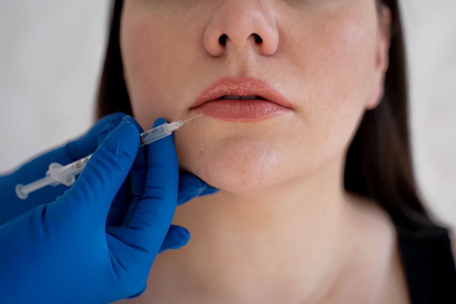 pantangan setelah suntik filler